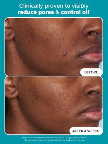 PAULA’S CHOICE 2% BHA LIQUID EXFOLIATIANT