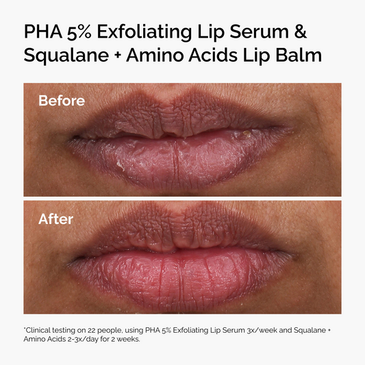 THE ORDINARY PHA EXFOLIATING LIP SERUM - 15ml
