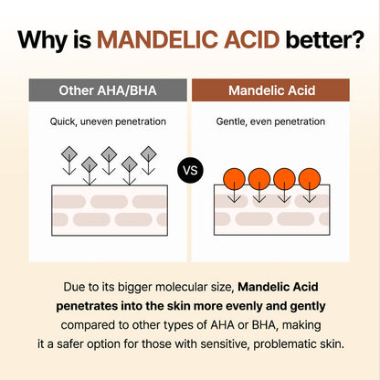 BY WISHTREND MANDELIC ACID 5% SKIN PREP WATER - 150ml